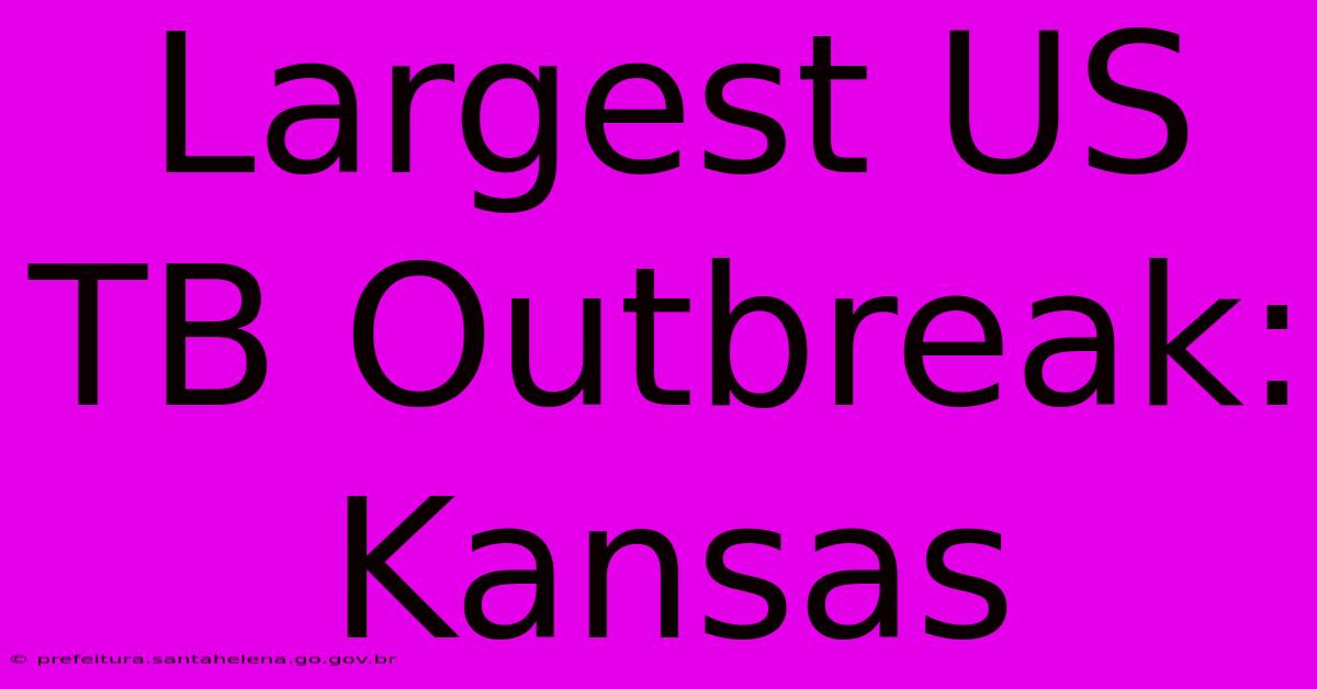 Largest US TB Outbreak: Kansas